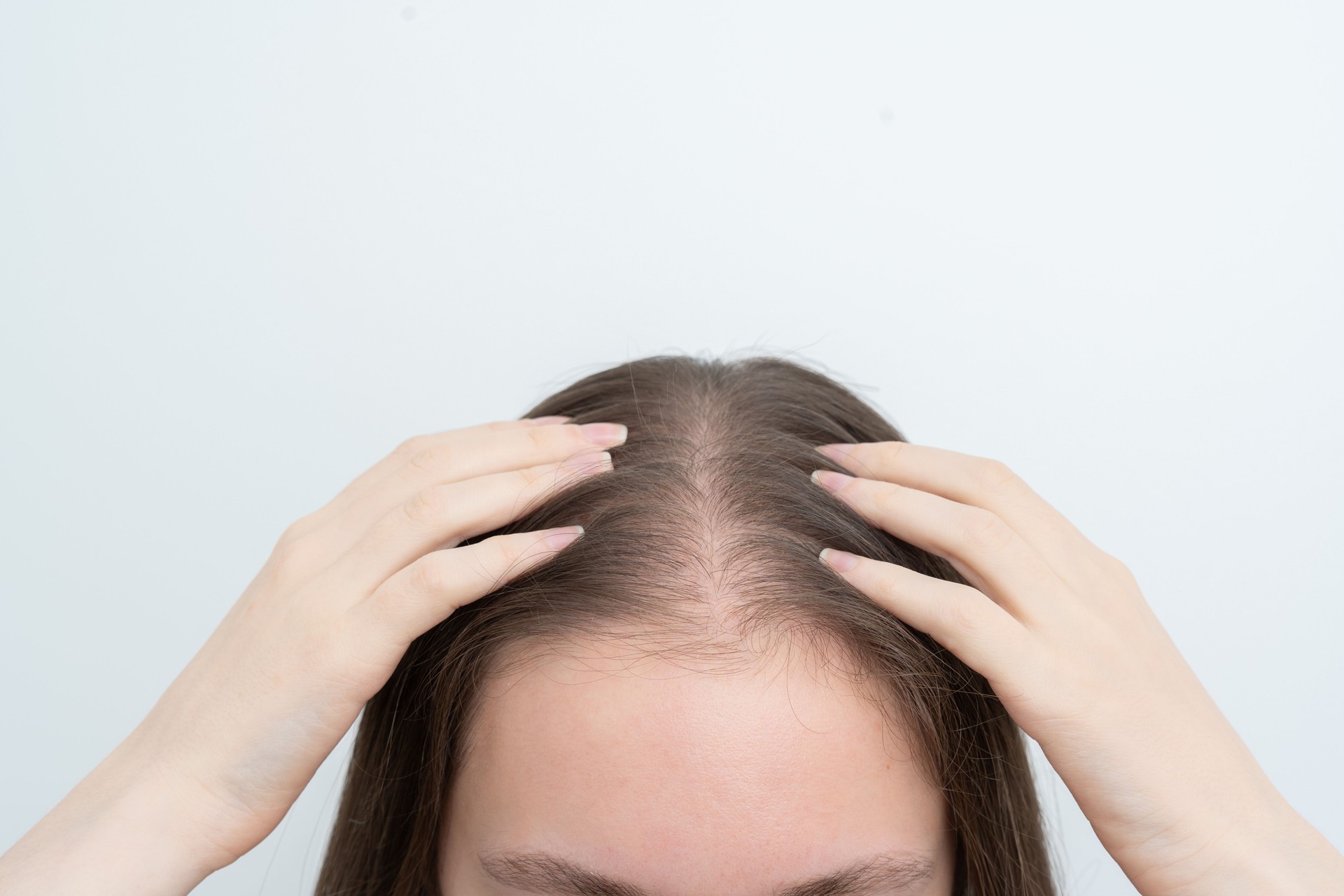 Close up view young woman massaging her scalp with hands for stimulating new hair growth, copy space. Receding hairline. Alopecia treatment, scalp stimulation, hair loss and baldness targeted therapy.
